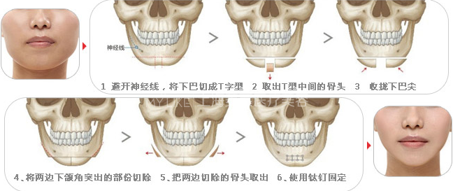 “大脸妹”的华丽蜕变