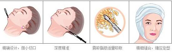 “大脸妹”的华丽蜕变