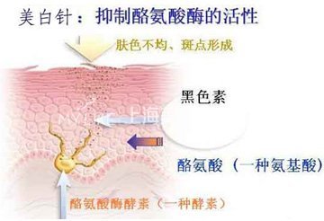 美白疗法解释