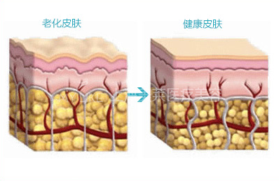 关于水光——做水光，水润过年啦！